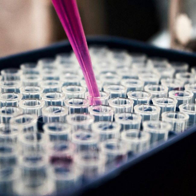 Sample testing in a lab
